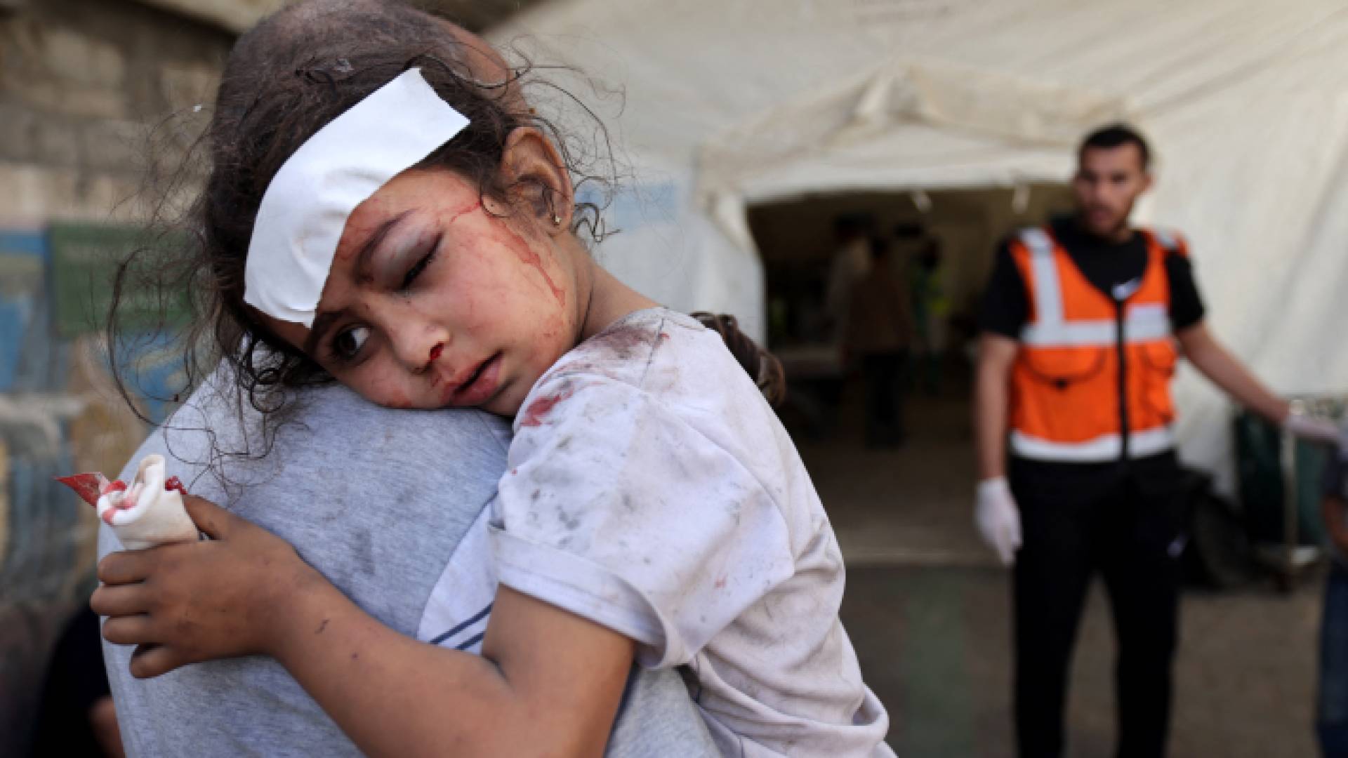 فتاة فلسطينية مصابة بقصف الاحتلال