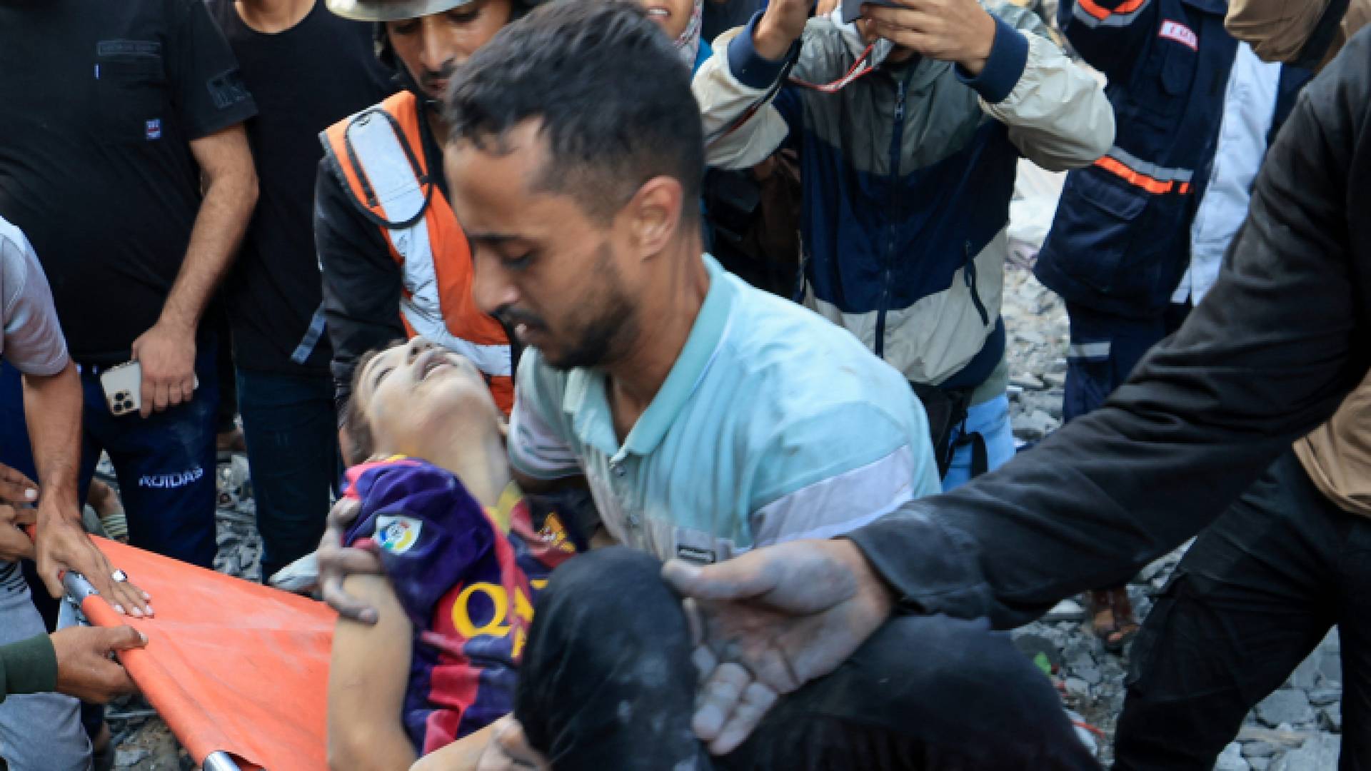 فلسطيني يحمل طفلة أصيبت جراء قصف الاحتلال الإسرائيلي