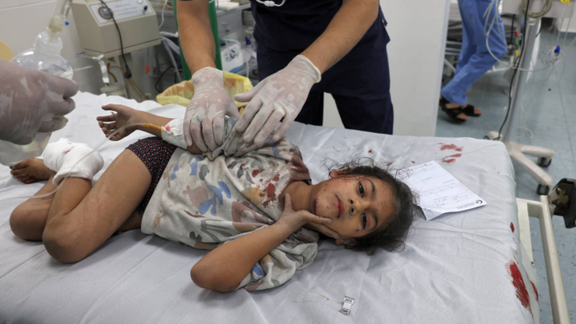 طفلة فلسطينية مصابة بقصف الاحتلال تتلقى العلاج في أحد مستشفيات القطاع