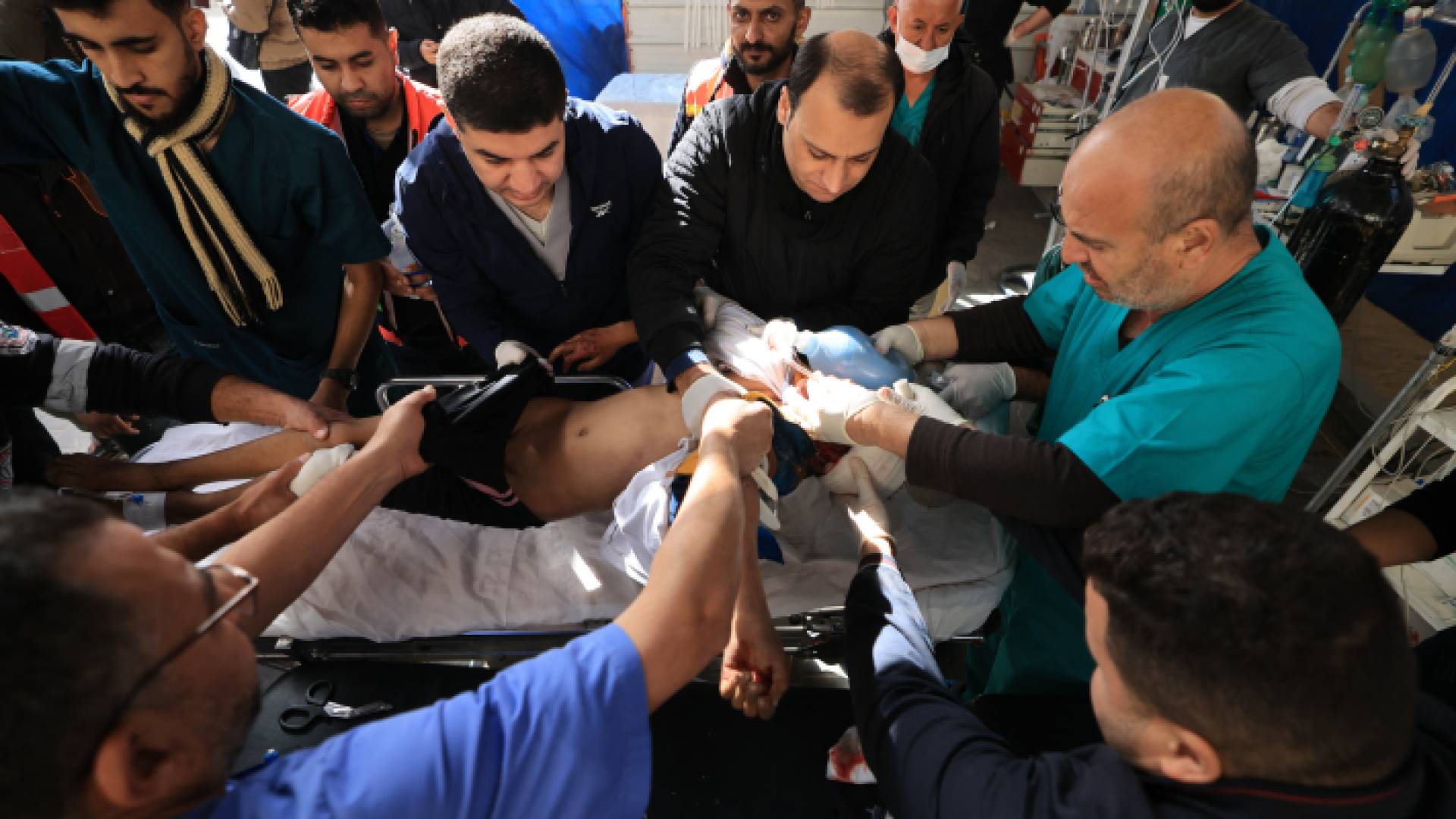 فرق طبية تحاول إسعاف فتى تعرض لإصابة جراء قصف الاحتلال الإسرائيلي في قطاع غزة