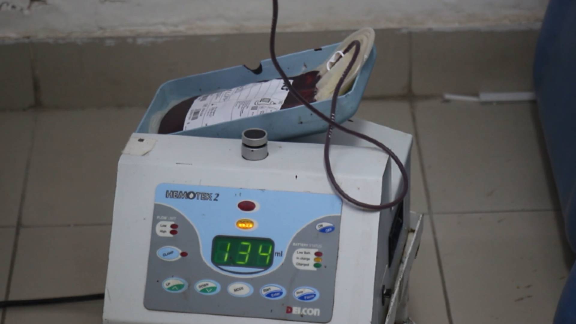 استحداث قسمي جراحة وباطني نساء بواقع 19 سريرا جديدا خلال العام الحالي