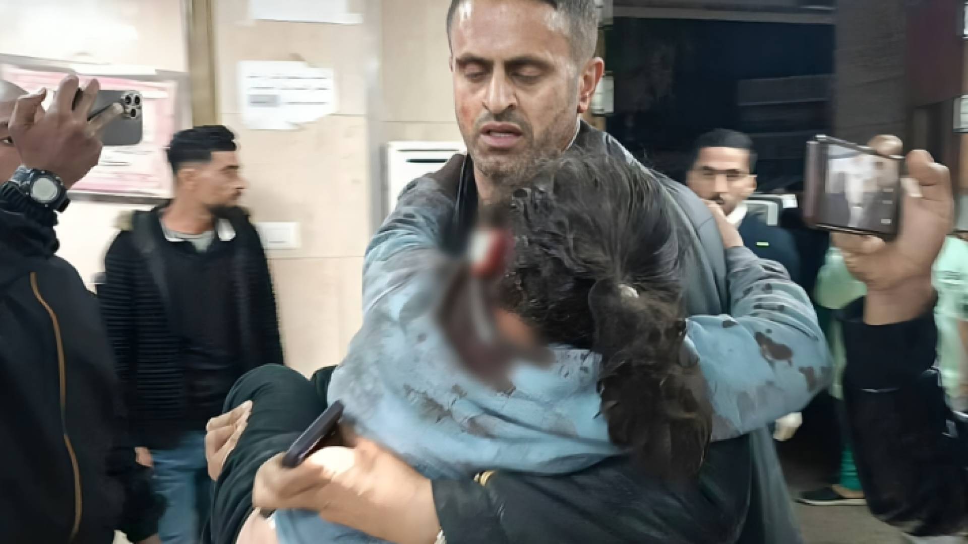 الفنان الفلسطيني محمود زعيتر يحمل صغيرة من أفراد عائلته لإسعافها