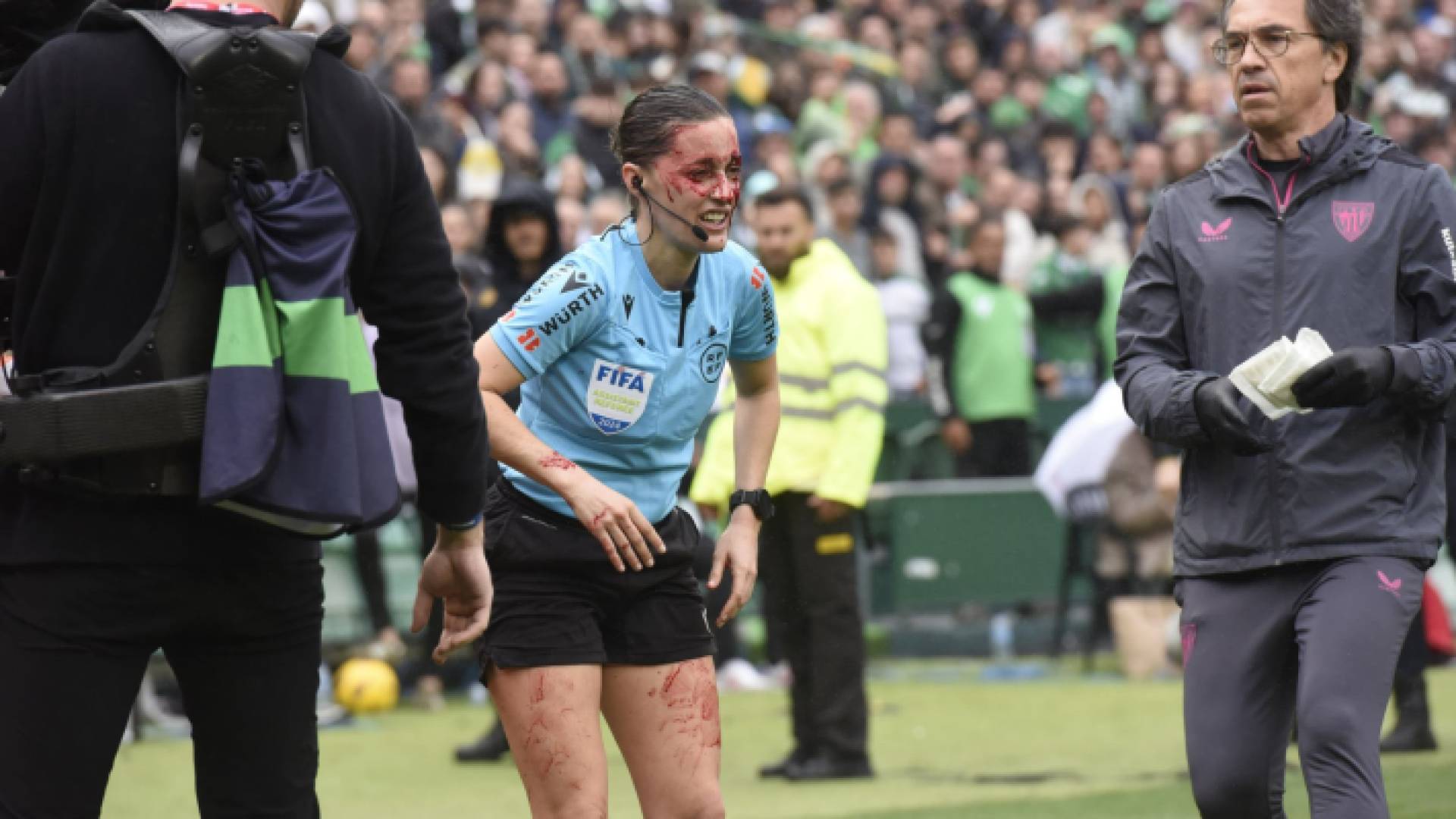 حكمة الراية جوادالوبي بوراس بعد تعرضها للإصابة