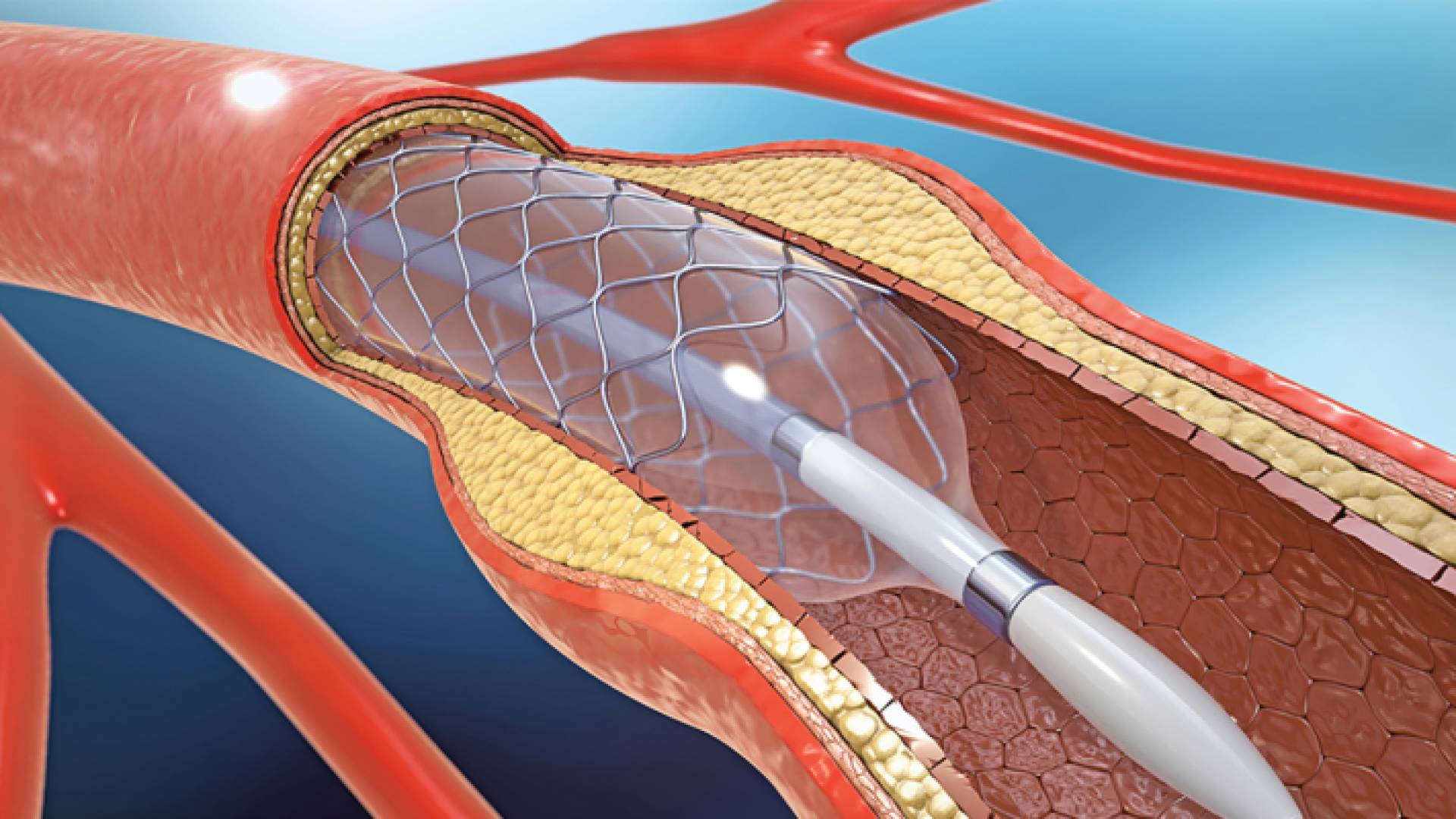 الشبكات القلبية