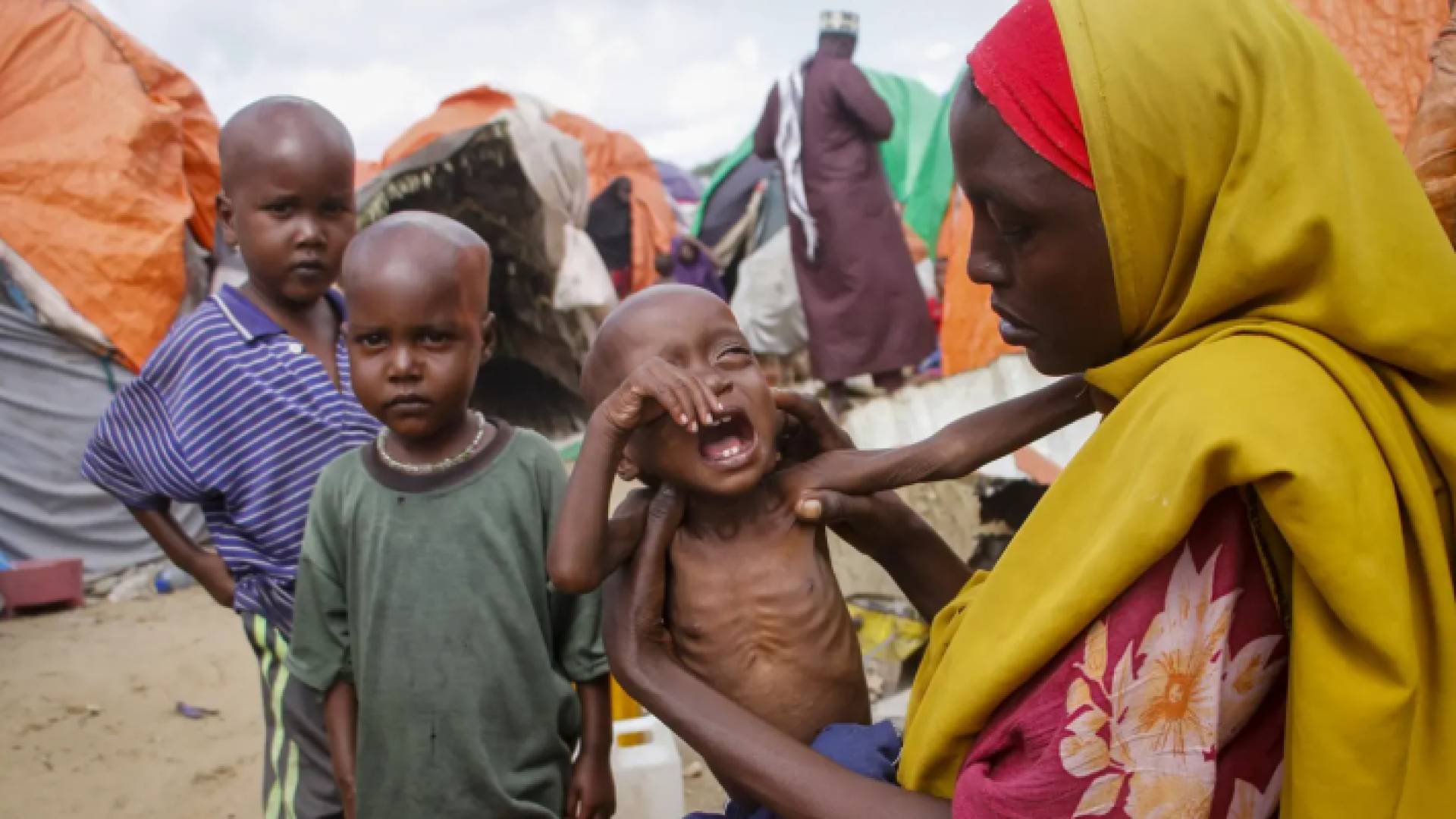 إمرأة تحمل طفلتها التعاني من سوء تغذية في أحد مخيمات مقديشيو