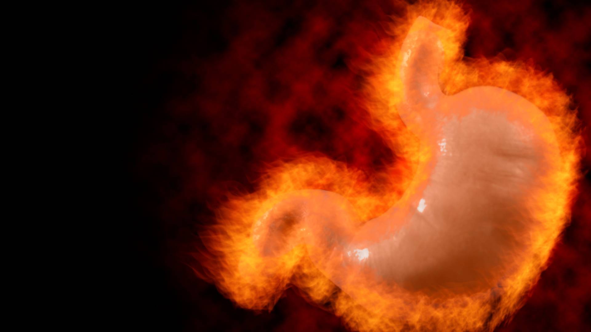 صورة تعبر عن تهيج الجهاز الهضمي