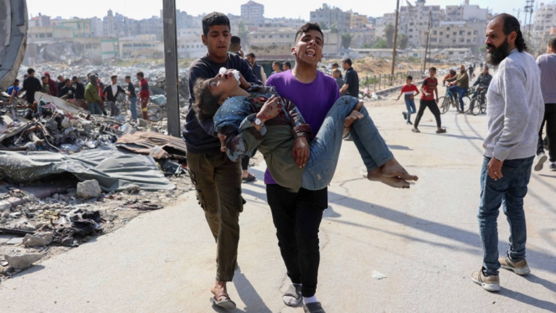 فتى يحمل شقيقته المصابة في غزة