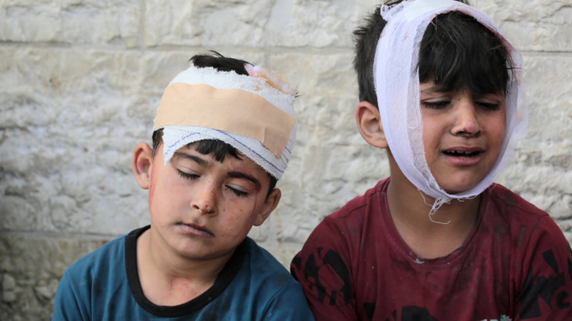 طفلان فلسطينيان مصابان