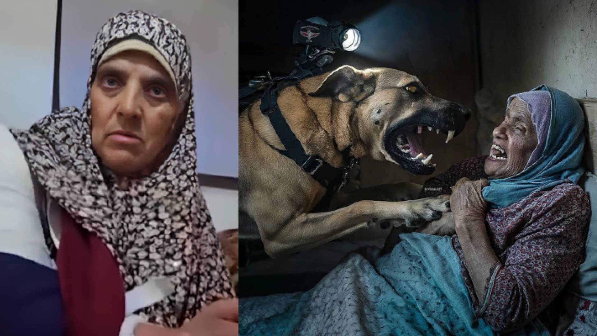 سيدة فلسطينية تعرضت لهجوم كلب للاحتلال