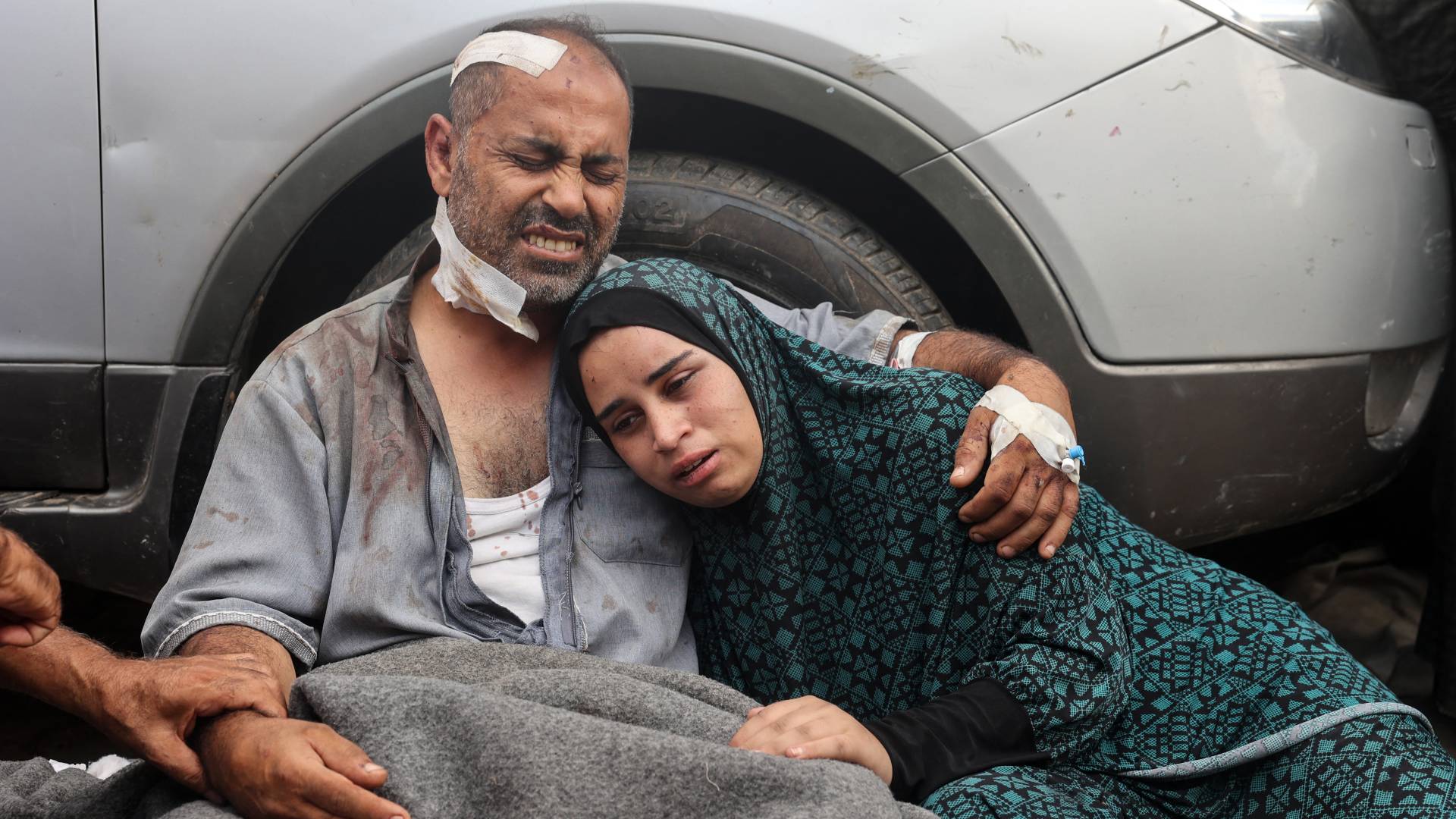 فلسطيني يختضن ابنته بعد إصابته بجروح نتيجة لعدوان الاحتلال على القطاع غزة