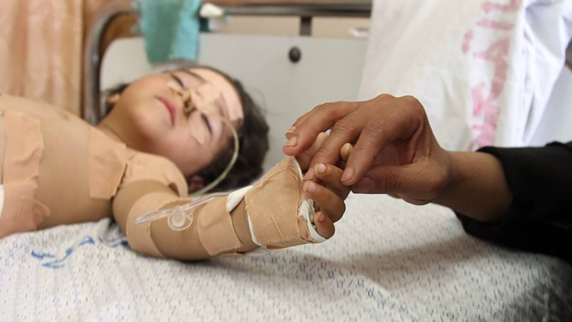 طفل مرض في غزة