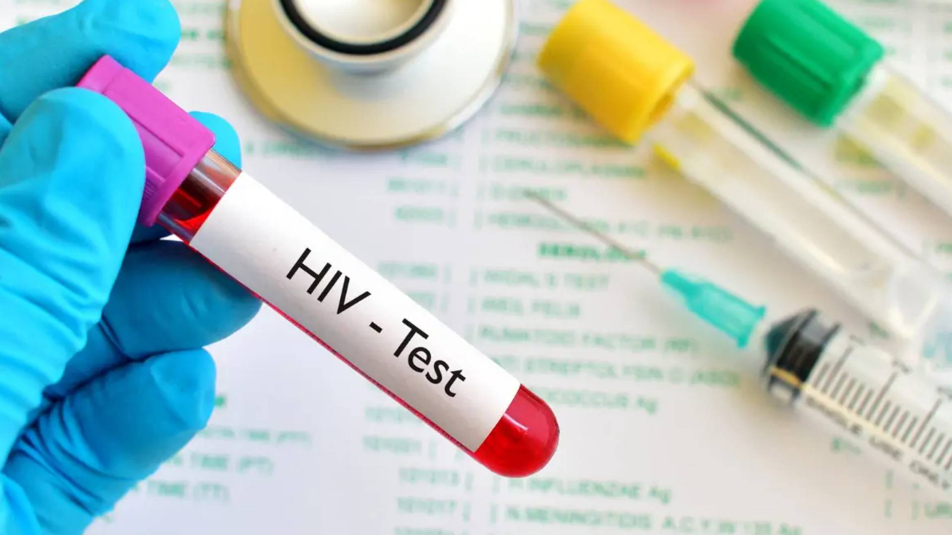 فحص الإيدز