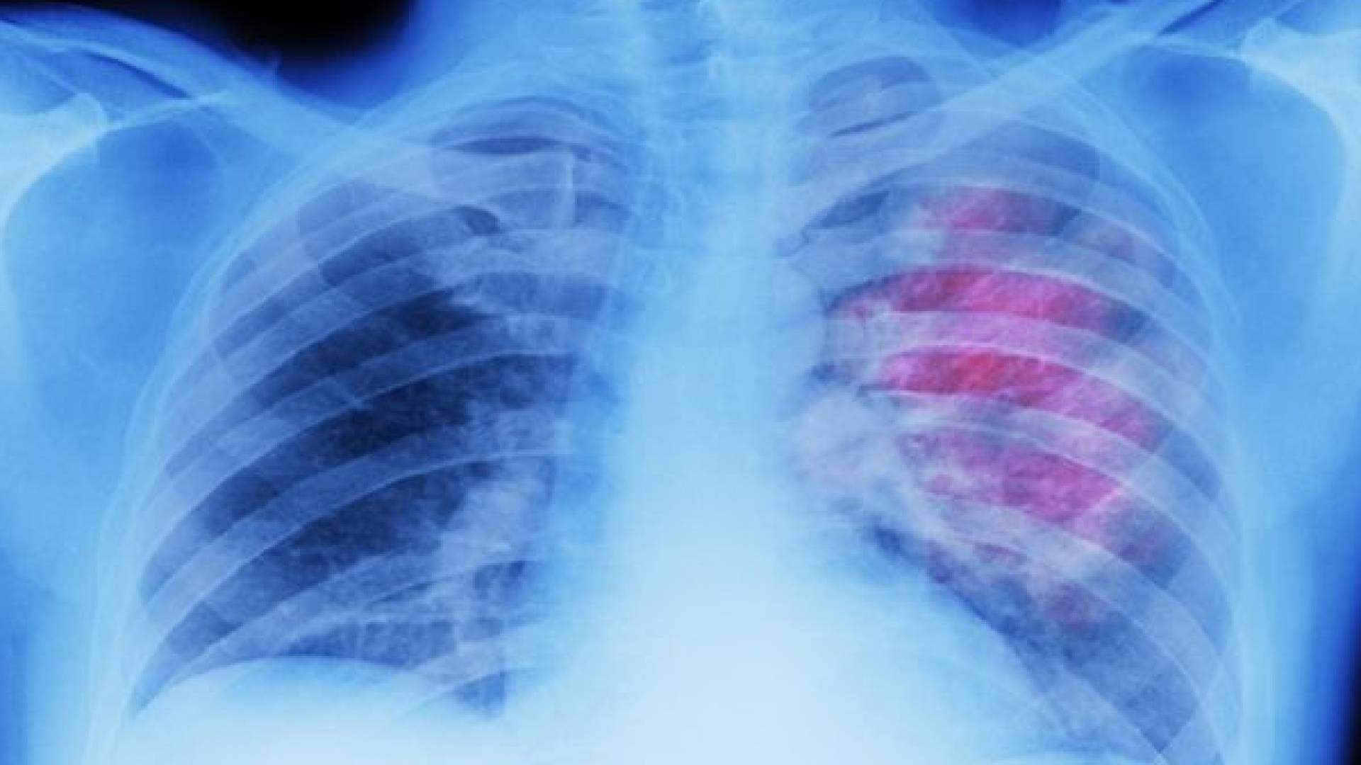 اثر الأمونيا على الجهاز التنفسي